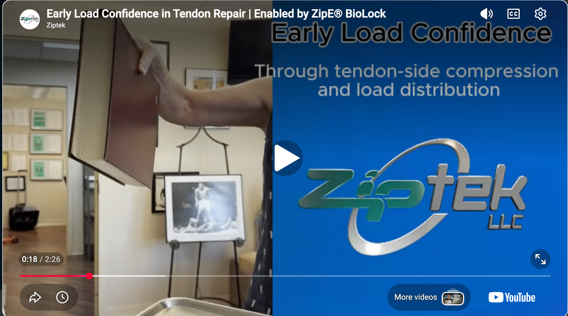 ZipTek Global - Surgical Repair Technology | Resorbable Locking Systems