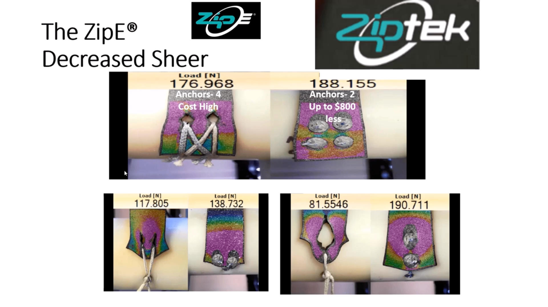 Ziptek ZipTek Global - Surgical Repair Technology | Resorbable Locking Systems