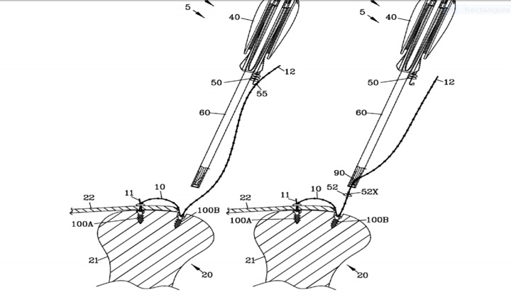 Trauma Joint Replacement-2